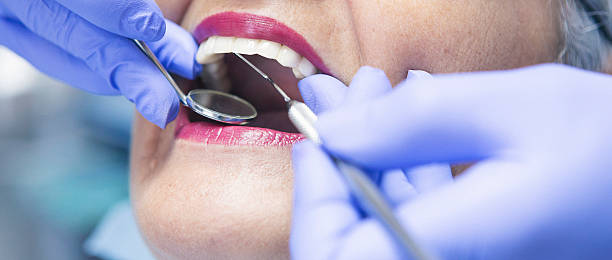 Best Broken or Chipped Tooth Repair in Heber, CA